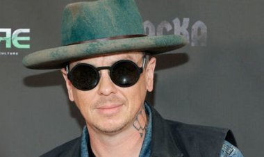 Sid Wilson Vows To Perform Live Despite Serious Burns